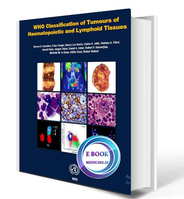 دانلود کتابWHO Classification of Tumours of Haematopoietic and Lymphoid Tissues2017 (  PDF)